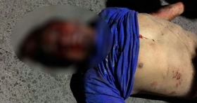 Su c&oacute;mplice logr&oacute; escapar en la motocicleta que presuntamente robaron