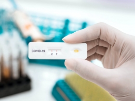 Farmac&eacute;utica Roche lanza prueba r&aacute;pida de ant&iacute;geno para detectar #COVID19