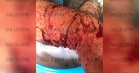 El m&aacute;s lesionado tuvo que ser trasladado a un nosocomio para su atenci&oacute;n   